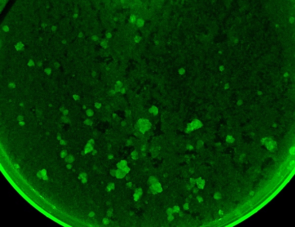 Buněčná kultura tabáku. Zeleně svítí kolonie buněk, do kterých byl vnesen gen pro světélkující bílkovinu.