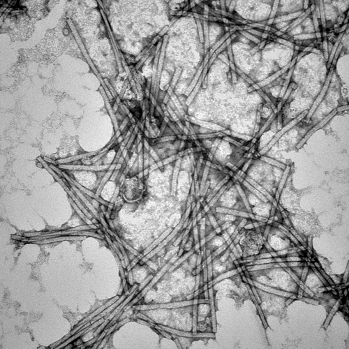 Částice viru tabákové mozaiky, zvětšené 71 000krát. Snímek byl pořízen transmisním elektronovým mikroskopem.