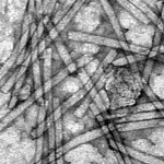 Částice viru tabákové mozaiky, zvětšené 71 000krát. Snímek byl pořízen transmisním elektronovým mikroskopem.