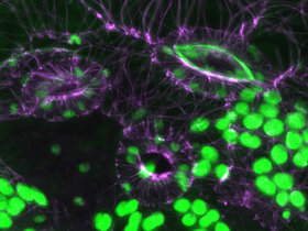 Buňky na spodní straně listu huseníčku. Fialově bílkovinná vlákna zvaná mikrotubuly, zeleně chloroplasty.