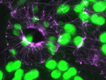 Buňky na spodní straně listu huseníčku. Fialově bílkovinná vlákna zvaná mikrotubuly, zeleně chloroplasty.