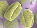Pylová zrna - uměle obarvený snímek z rastrovacího elektronového mikroskopu. Foto Lukáš Synek.