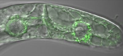 Bílkovina PIN5 (zeleně) v buňkách tabáku. Foto Petr Skůpa.