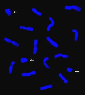 Chromozómy žita setého. V tomto případě 7 párů běžných chromozómů a 3 menší B chromozómy (označeny šipkou).