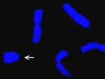 Chromozómy žita setého. V tomto případě 7 párů běžných chromozómů a 3 menší B chromozómy (označeny šipkou).