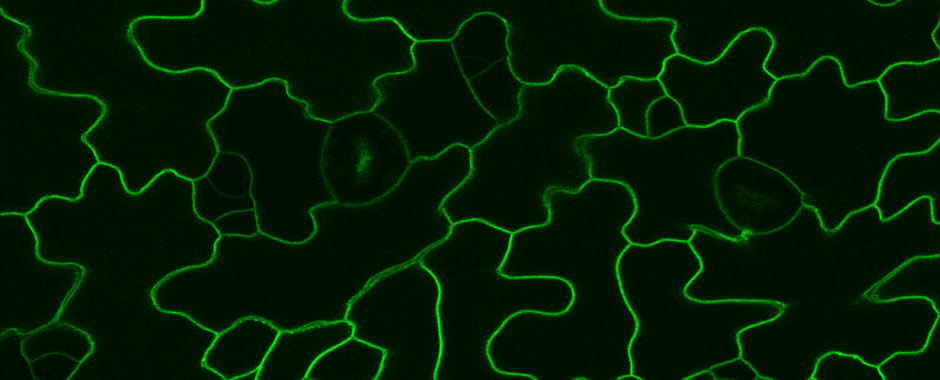 Pokožkové buňky listu